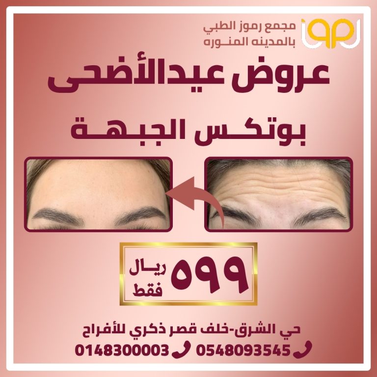 بوتكس الجبهة
