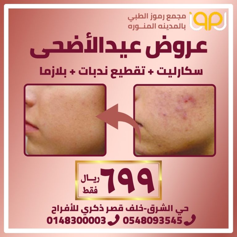 سكارليت-مع-تقطيع-ندبات-مع-بلازما