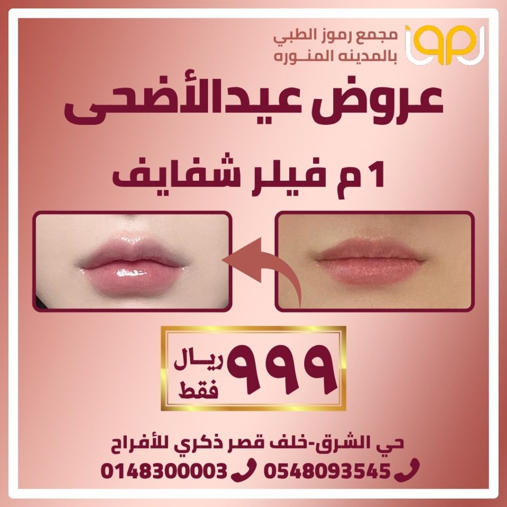 فيلر شفايف
